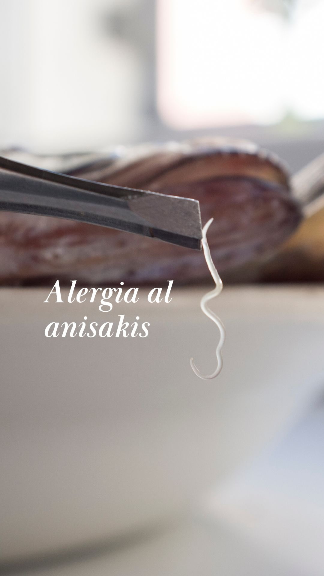 🐟 ¿Alguna vez te ha sentado mal el pescado sin saber por qué?

El anisakis es un parásito que puede estar presente en muchos pescados. Los pacientes alérgicos, al ingerirlo, pueden presentar una reacción alérgica porque la larva se adhiere a la mucosa digestiva y libera sustancias que activan el sistema inmune.

⏱️ Lo más habitual es que los síntomas aparezcan entre 15 minutos y 2 horas después de comer pescado.
Pueden ser:
• Urticaria o hinchazón
• Dolor abdominal, náuseas o vómitos
• En casos más graves, reacción generalizada (anafilaxia)

👩🏻‍⚕️ Para confirmarlo, se realizan pruebas de alergia (prick test y/o analítica con IgE específica).

💡 Y aquí es donde entra la clave: ¡la prevención con las 4 Cs!

✨ Si has tenido síntomas tras comer pescado, pide cita y valoramos tu caso de forma personalizada.
.
#anisakis #alergiaalimentaria #pescado #seguridadalimentaria #alergias prevencion saluddigestiva alergologia granollers paularibo